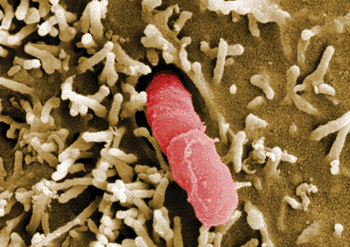 Imagen: Microfotografía electrónica de barrido de Yersinia pseudotuberculosis (Fotografía cortesía del Centro Helmholtz para la Investigación de Infecciones).